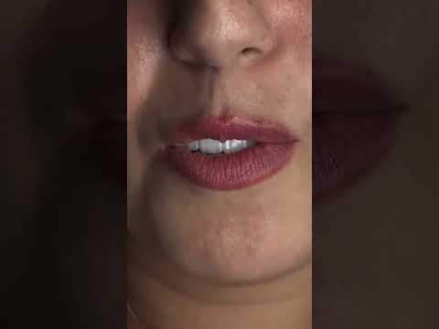 Vidéo 3 du Dr Hani Samai