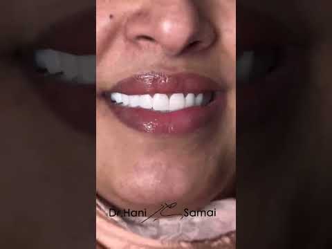 Vidéo 6 du Dr Hani Samai
