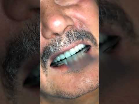 Vidéo 8 du Dr Hani Samai