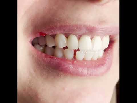 Vidéo 9 du Dr Hani Samai